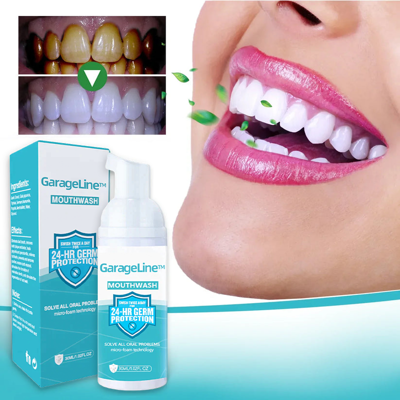 2024 brand new event GarageLine tooth mousse (For all kinds of oral problems, especially teeth regeneration)