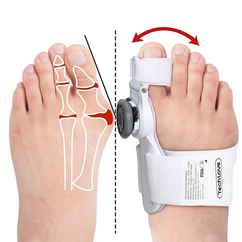 Upgraded Bunion Corrector - 3D Knob Toe Corrector