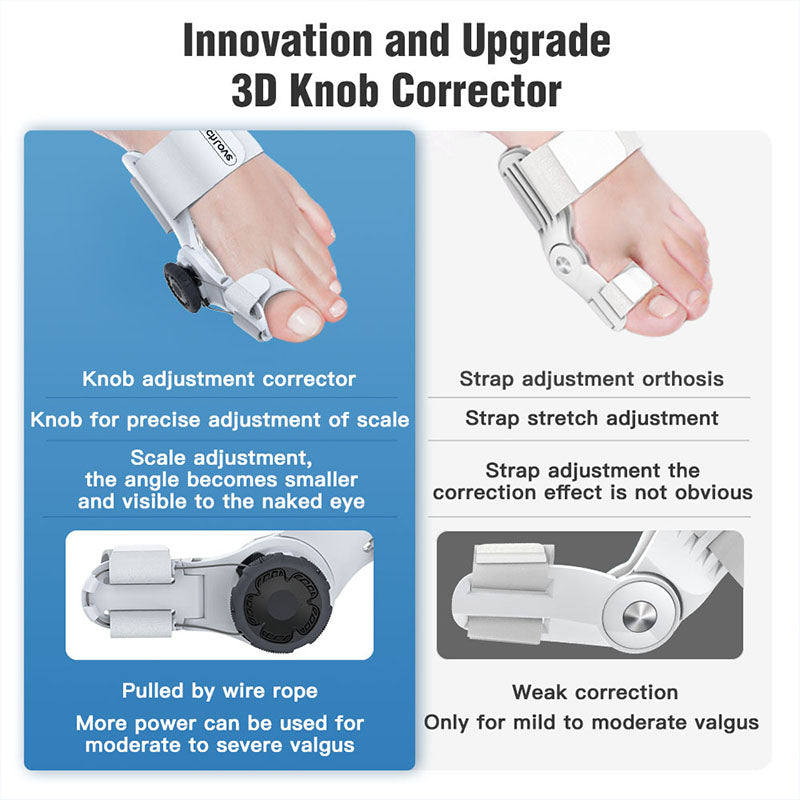 Upgraded Bunion Corrector - 3D Knob Toe Corrector