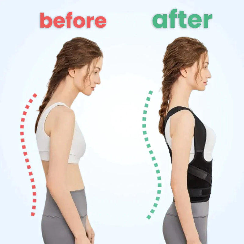 (60% OFF) Instant Posture Corrector