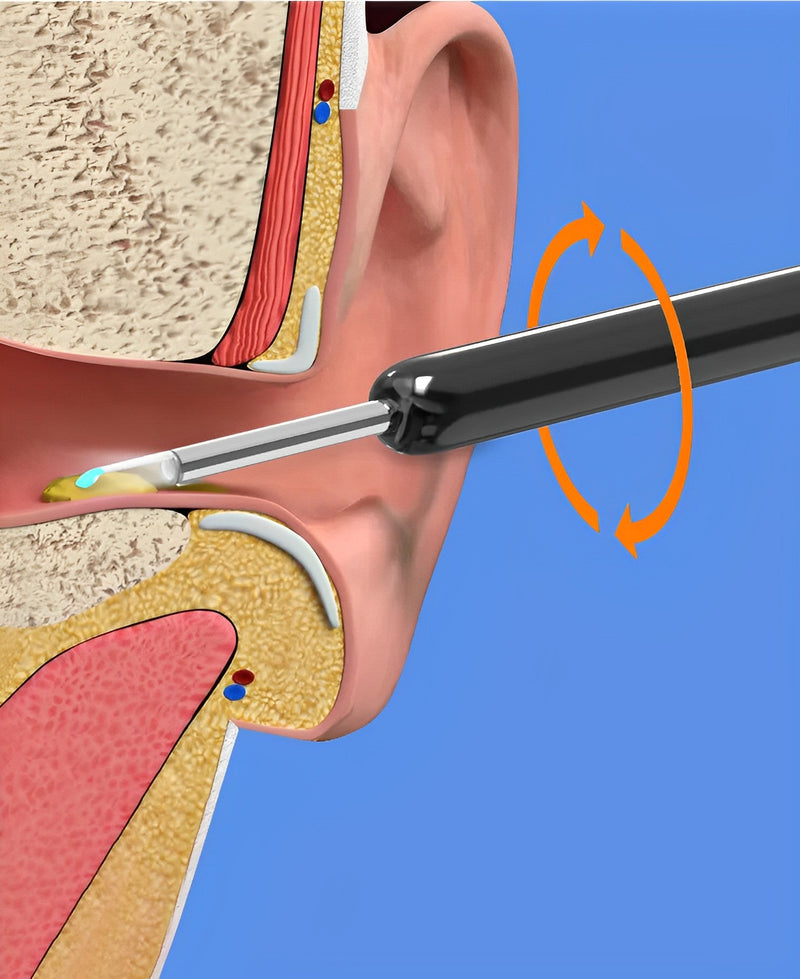 EarBit 3000 - Ear Cleaning Tool With a Camera