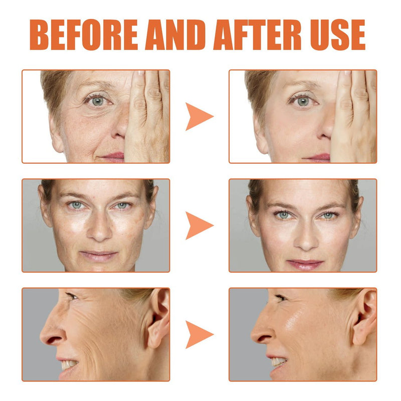 Duplicaten (Last Day Promotion 49% OFF) – Botox Face Serum