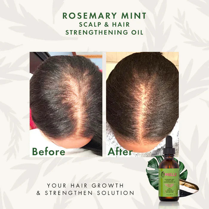 Limited Freshbles Hair Strengthening Oil