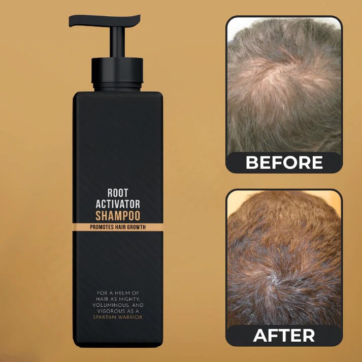 Root activator shampoo